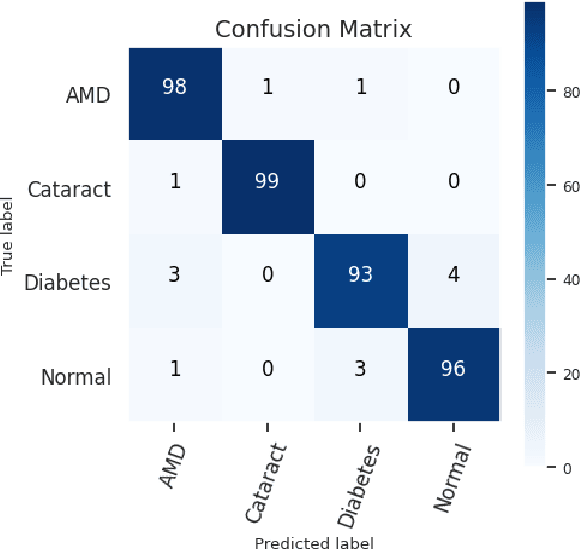 Figure 4 for AMDNet23: A combined deep Contour-based Convolutional Neural Network and Long Short Term Memory system to diagnose Age-related Macular Degeneration