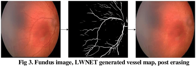 Figure 3 for Novel Fundus Image Preprocessing for Retcam Images to Improve Deep Learning Classification of Retinopathy of Prematurity