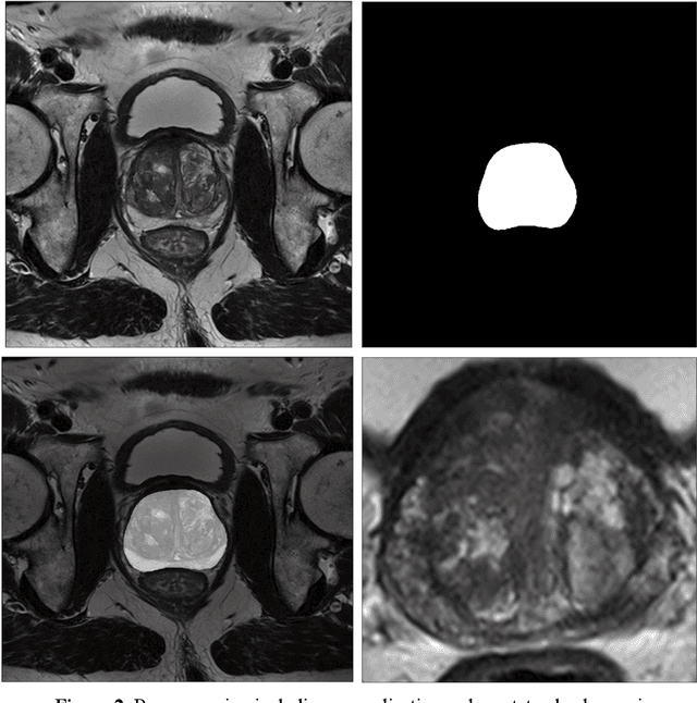 Figure 4 for Prostate Age Gap (PAG): An MRI surrogate marker of aging for prostate cancer detection