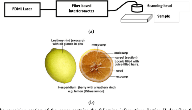 Figure 1 for Modified watershed approach for segmentation of complex optical coherence tomographic images
