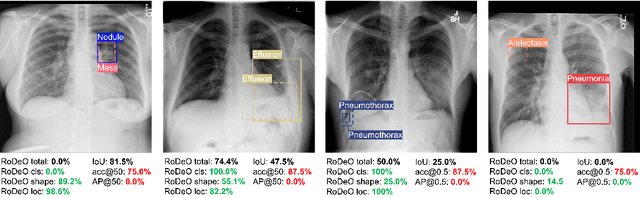 Figure 1 for Robust Detection Outcome: A Metric for Pathology Detection in Medical Images