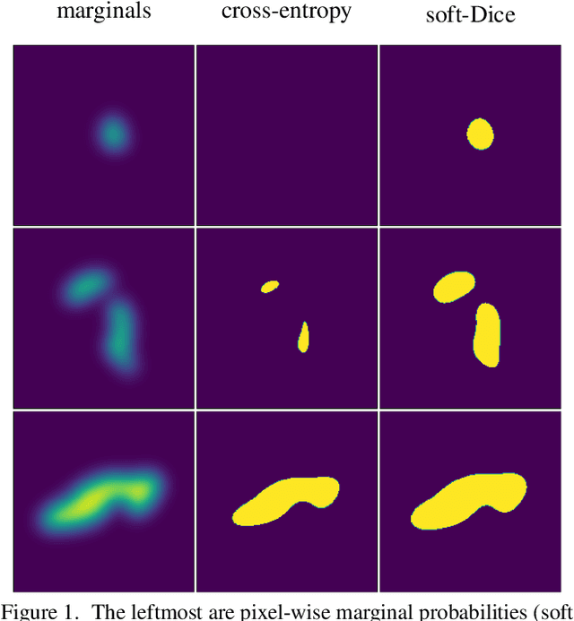 Figure 1 for Noisy Image Segmentation With Soft-Dice