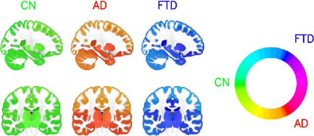 Figure 3 for Deep grading for MRI-based differential diagnosis of Alzheimer's disease and Frontotemporal dementia