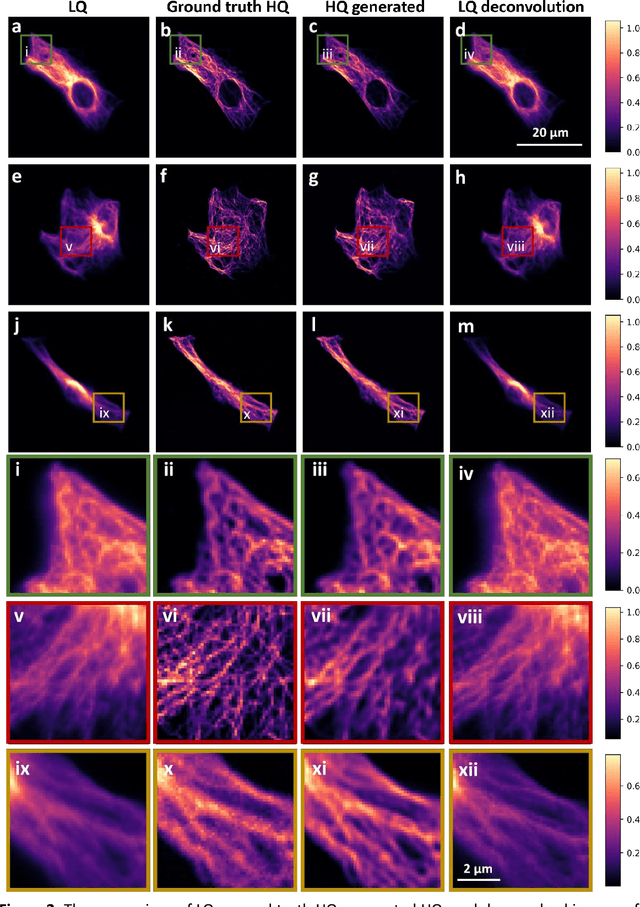 Figure 3 for Cross-system biological image quality enhancement based on the generative adversarial network as a foundation for establishing a multi-institute microscopy cooperative network