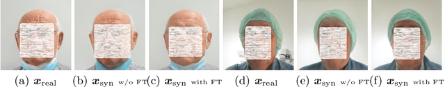 Figure 1 for Deep Learning for Cancer Prognosis Prediction Using Portrait Photos by StyleGAN Embedding