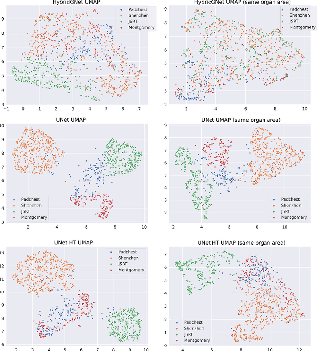 Figure 4 for Multi-center anatomical segmentation with heterogeneous labels via landmark-based models