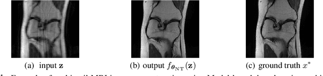 Figure 1 for On the Robustness of deep learning-based MRI Reconstruction to image transformations