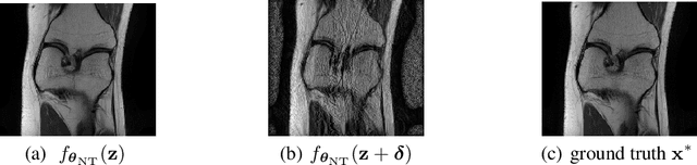 Figure 3 for On the Robustness of deep learning-based MRI Reconstruction to image transformations