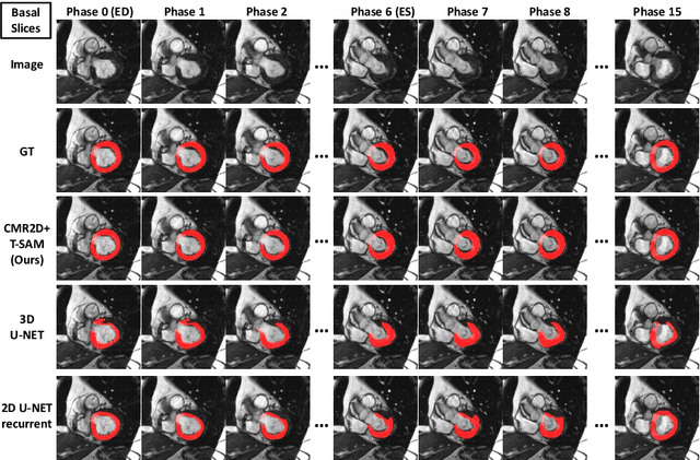 Figure 3 for Cardiac Magnetic Resonance 2D+T Short- and Long-axis Segmentation via Spatio-temporal SAM Adaptation