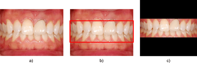 Figure 1 for Towards Earlier Detection of Oral Diseases On Smartphones Using Oral and Dental RGB Images