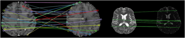 Figure 3 for Utilizing Radiomic Feature Analysis For Automated MRI Keypoint Detection: Enhancing Graph Applications