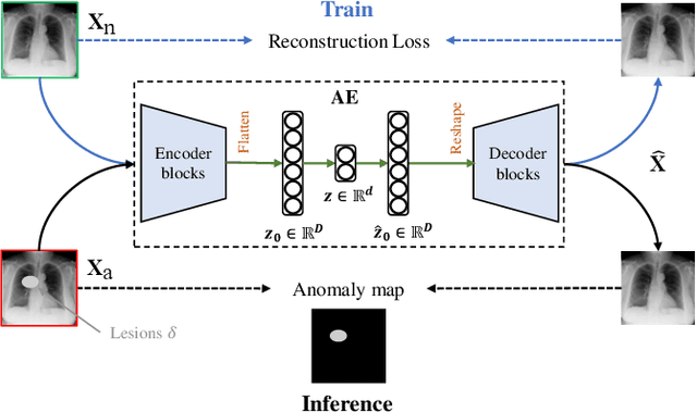 Figure 1 for Rethinking Autoencoders for Medical Anomaly Detection from A Theoretical Perspective