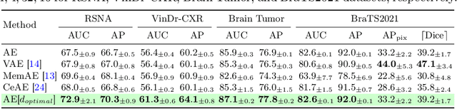 Figure 4 for Rethinking Autoencoders for Medical Anomaly Detection from A Theoretical Perspective