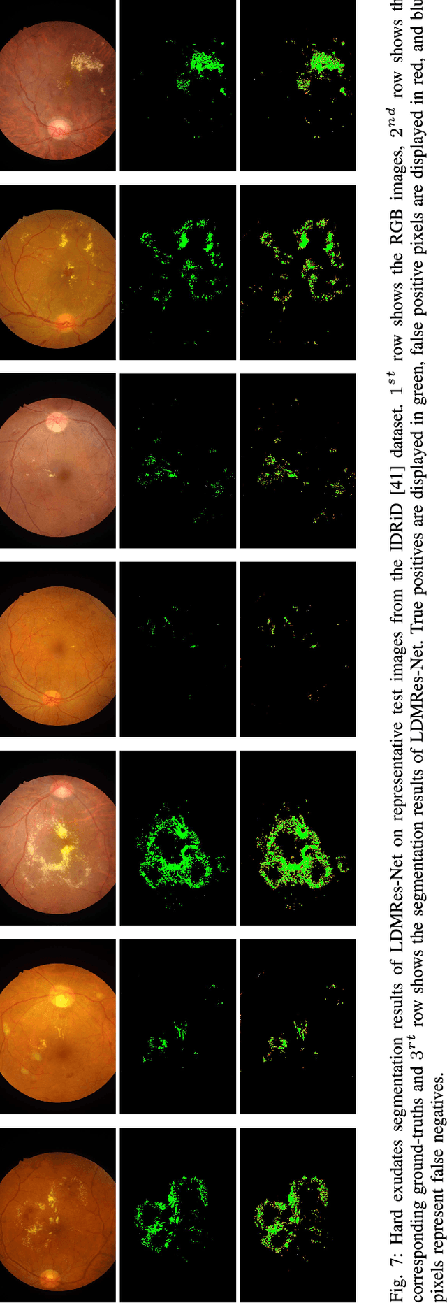 Figure 4 for LDMRes-Net: Enabling Real-Time Disease Monitoring through Efficient Image Segmentation