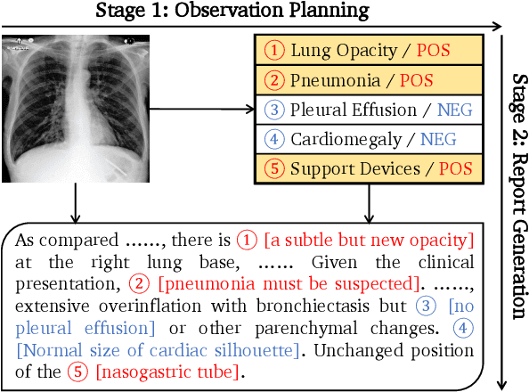 Figure 1 for ORGAN: Observation-Guided Radiology Report Generation via Tree Reasoning