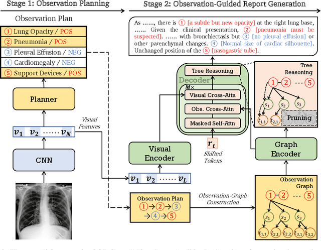 Figure 3 for ORGAN: Observation-Guided Radiology Report Generation via Tree Reasoning