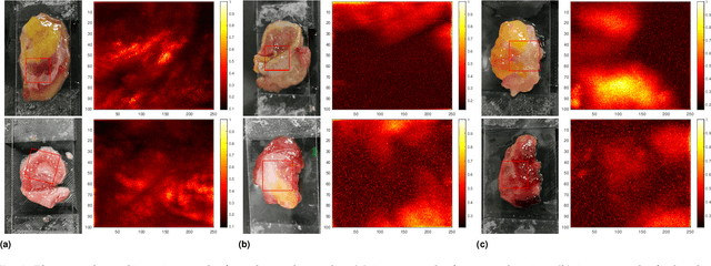 Figure 3 for Machine-Learning-based Colorectal Tissue Classification via Acoustic Resolution Photoacoustic Microscopy