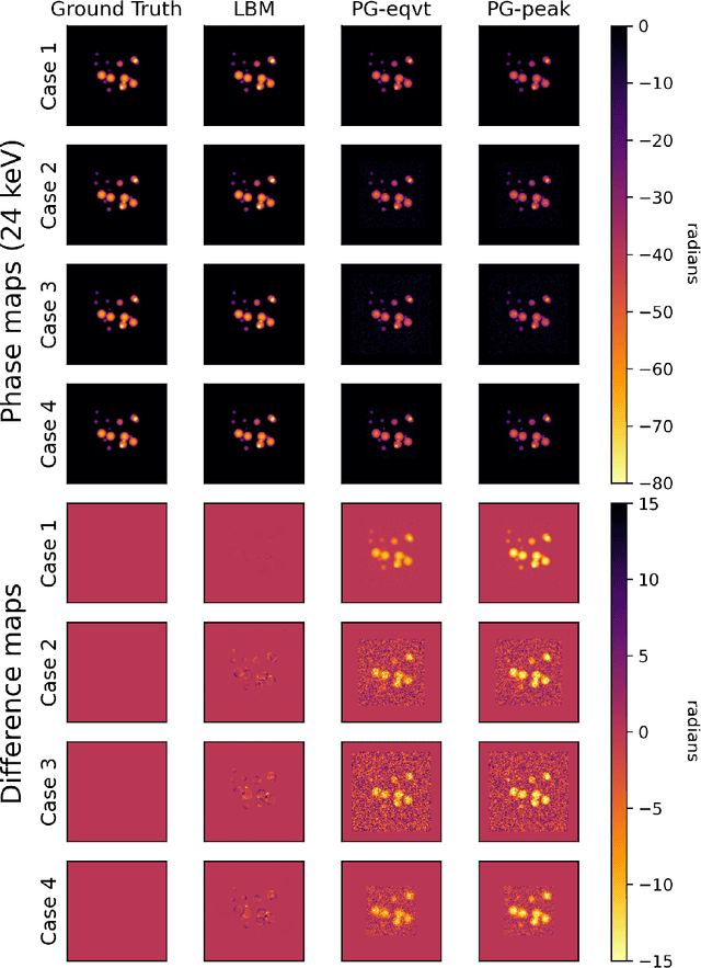 Figure 3 for Investigating the robustness of a learning-based method for quantitative phase retrieval from propagation-based x-ray phase contrast measurements under laboratory conditions