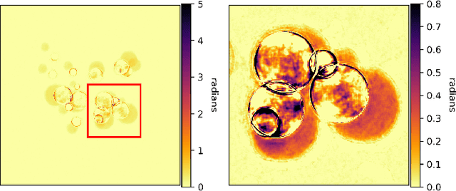 Figure 4 for Investigating the robustness of a learning-based method for quantitative phase retrieval from propagation-based x-ray phase contrast measurements under laboratory conditions