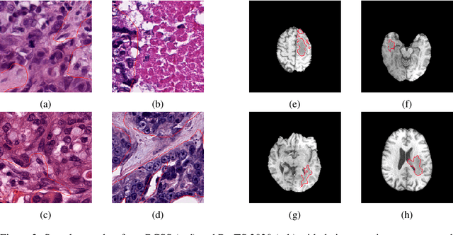Figure 3 for Exploring SAM Ablations for Enhancing Medical Segmentation in Radiology and Pathology