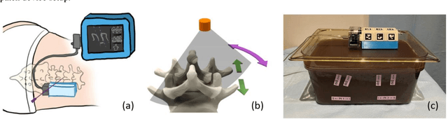 Figure 1 for Feature-aggregated spatiotemporal spine surface estimation for wearable patch ultrasound volumetric imaging