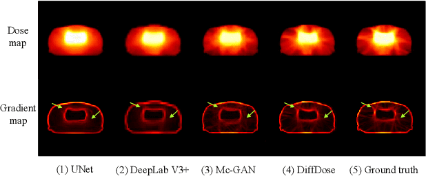 Figure 1 for Diffusion-based Radiotherapy Dose Prediction Guided by Inter-slice Aware Structure Encoding