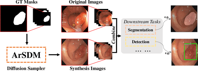 Figure 1 for ArSDM: Colonoscopy Images Synthesis with Adaptive Refinement Semantic Diffusion Models