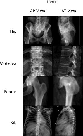 Figure 1 for Benchmarking Encoder-Decoder Architectures for Biplanar X-ray to 3D Shape Reconstruction