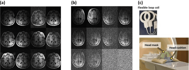 Figure 1 for Deep-learning-based acceleration of MRI for radiotherapy planning of pediatric patients with brain tumors