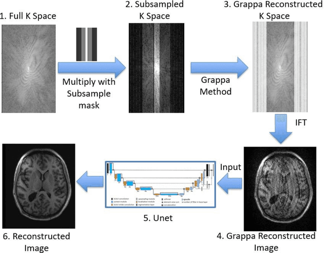 Figure 3 for Deep-learning-based acceleration of MRI for radiotherapy planning of pediatric patients with brain tumors