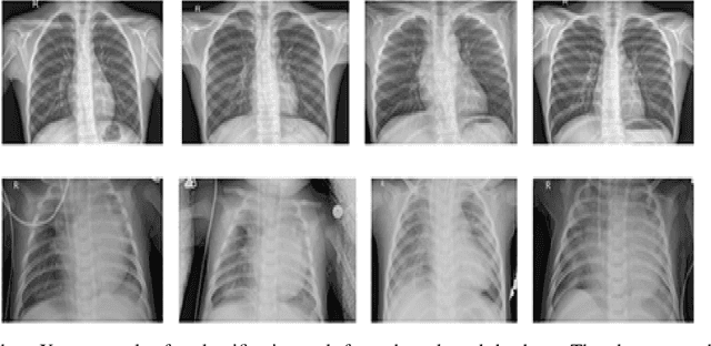 Figure 2 for Pneumonia Detection on chest X-ray images Using Ensemble of Deep Convolutional Neural Networks