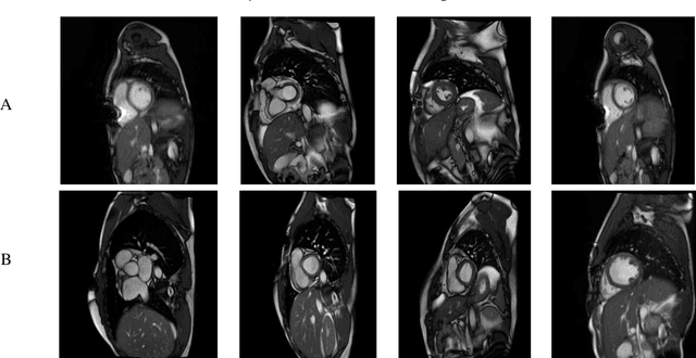 Figure 3 for Automatic Diagnosis of Myocarditis Disease in Cardiac MRI Modality using Deep Transformers and Explainable Artificial Intelligence