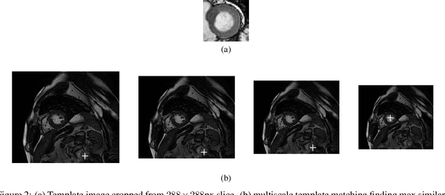 Figure 2 for Automatic Segmentation of Left Ventricle in Cardiac Magnetic Resonance Images