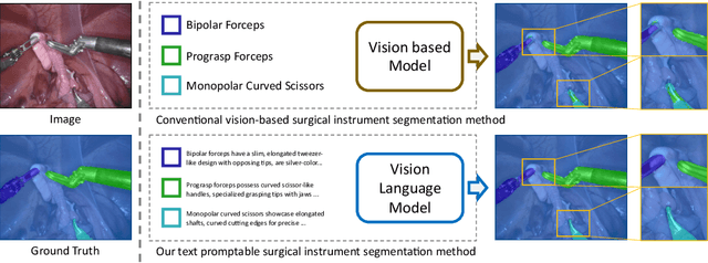Figure 1 for Text Promptable Surgical Instrument Segmentation with Vision-Language Models