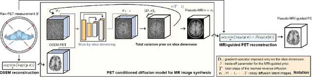 Figure 1 for Pseudo-MRI-Guided PET Image Reconstruction Method Based on a Diffusion Probabilistic Model