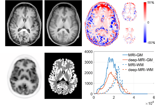 Figure 2 for Pseudo-MRI-Guided PET Image Reconstruction Method Based on a Diffusion Probabilistic Model