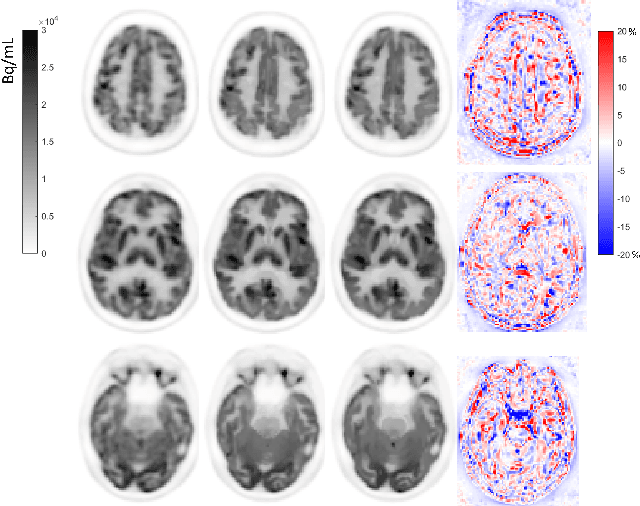 Figure 3 for Pseudo-MRI-Guided PET Image Reconstruction Method Based on a Diffusion Probabilistic Model