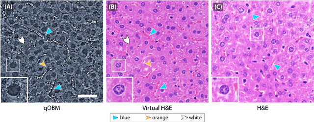 Figure 3 for Label- and slide-free tissue histology using 3D epi-mode quantitative phase imaging and virtual H&E staining