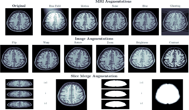 Figure 2 for Deepbet: Fast brain extraction of T1-weighted MRI using Convolutional Neural Networks