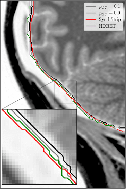 Figure 4 for Deepbet: Fast brain extraction of T1-weighted MRI using Convolutional Neural Networks