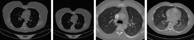 Figure 1 for A Deep Neural Architecture for Harmonizing 3-D Input Data Analysis and Decision Making in Medical Imaging