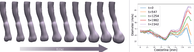 Figure 3 for Implicit Neural Representations for Modeling of Abdominal Aortic Aneurysm Progression