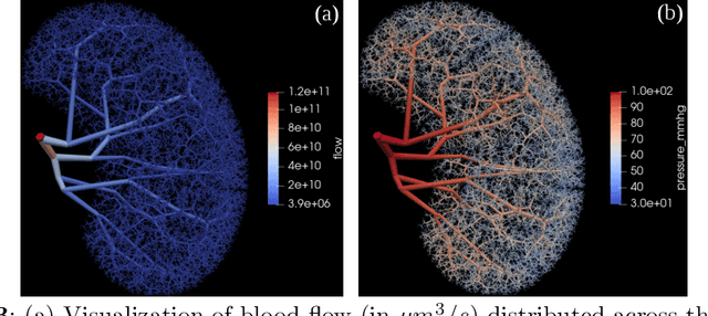 Figure 3 for A Hybrid Approach to Full-Scale Reconstruction of Renal Arterial Network