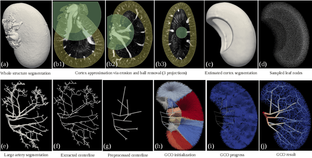 Figure 1 for A Hybrid Approach to Full-Scale Reconstruction of Renal Arterial Network