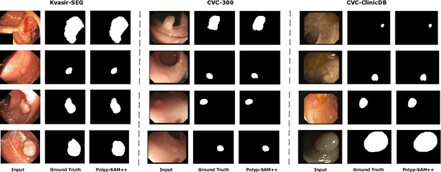 Figure 3 for Polyp-SAM++: Can A Text Guided SAM Perform Better for Polyp Segmentation?