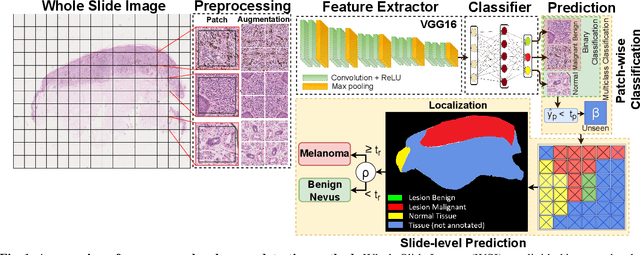 Figure 1 for Detection and Localization of Melanoma Skin Cancer in Histopathological Whole Slide Images