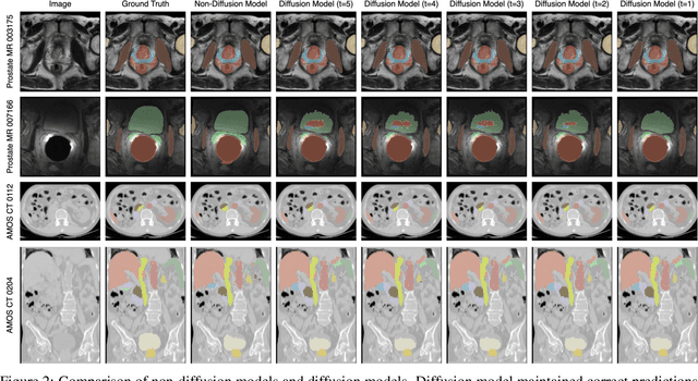 Figure 3 for Importance of Aligning Training Strategy with Evaluation for Diffusion Models in 3D Multiclass Segmentation