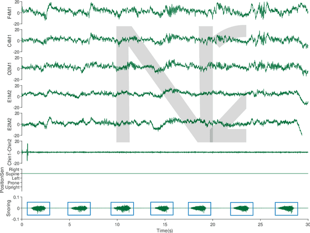 Figure 3 for A Snoring Sound Dataset for Body Position Recognition: Collection, Annotation, and Analysis