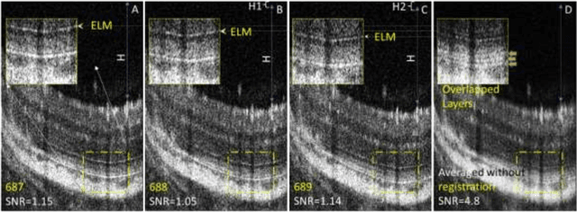 Figure 1 for AI pipeline for accurate retinal layer segmentation using OCT 3D images