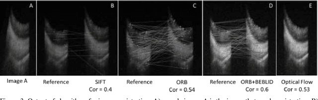 Figure 4 for AI pipeline for accurate retinal layer segmentation using OCT 3D images